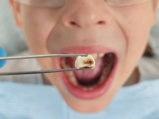 Best Emergency Denture Repair in Buckeystown, MD